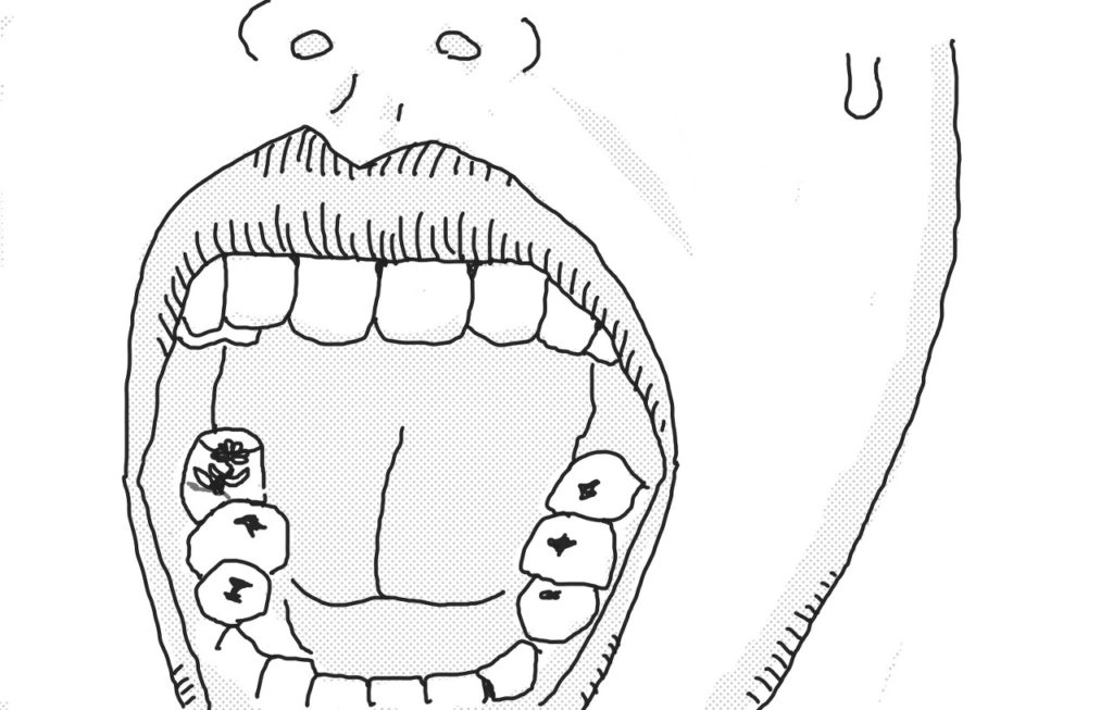 Implant and Tooth-Plant