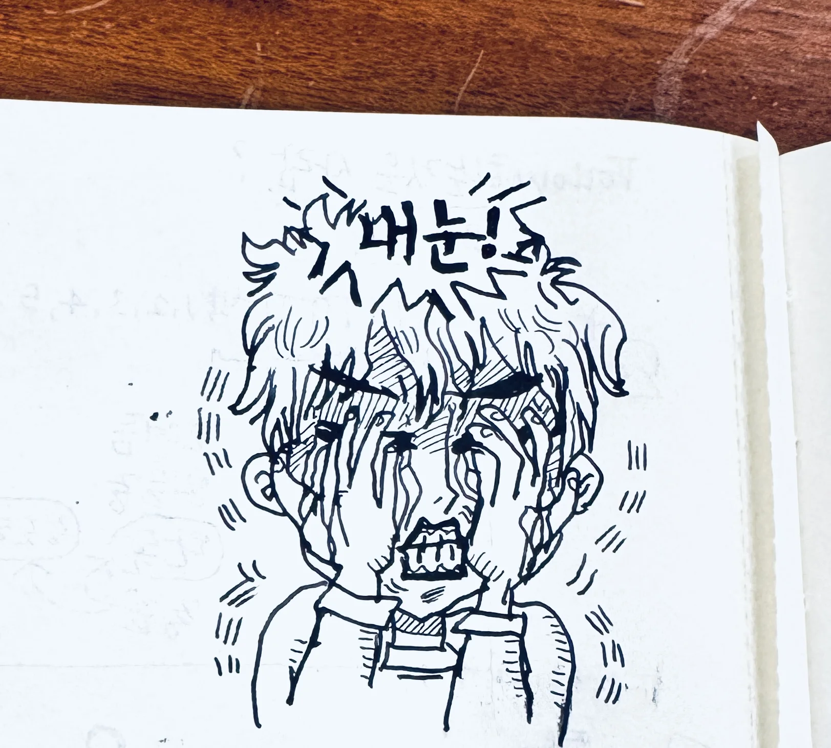 Conjunctivitis 2